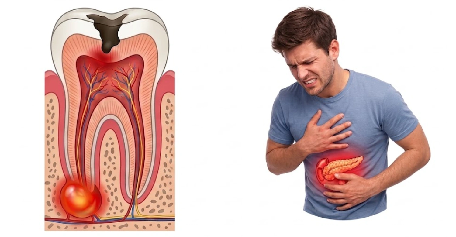 Tooth infection and pancreatitis